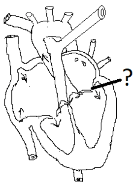 The cross section of the heart showing bicuspid valve
