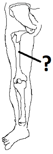 The given diagram represents the hind limb or the leg femur of the human body