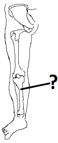 The given diagram shows the hind limb or the leg Tibia of the human body