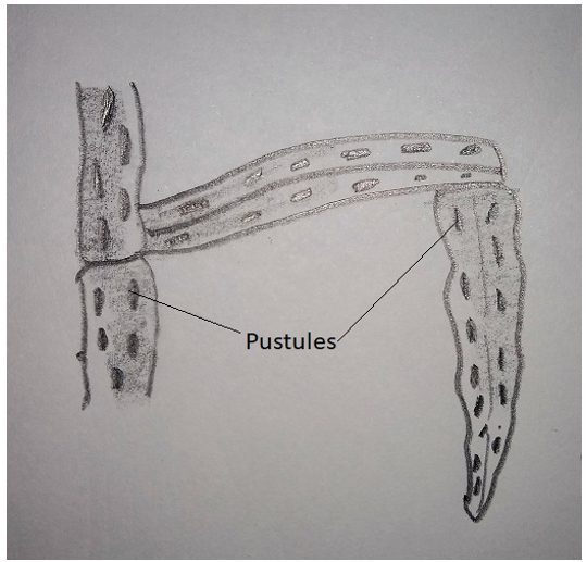 Diagram represents infected black stem rust of wheat developing on leaves