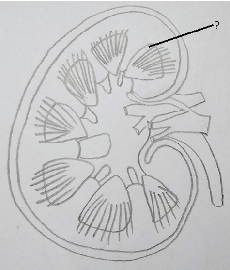 Find what the question mark represents in the given figure of Human Kidney