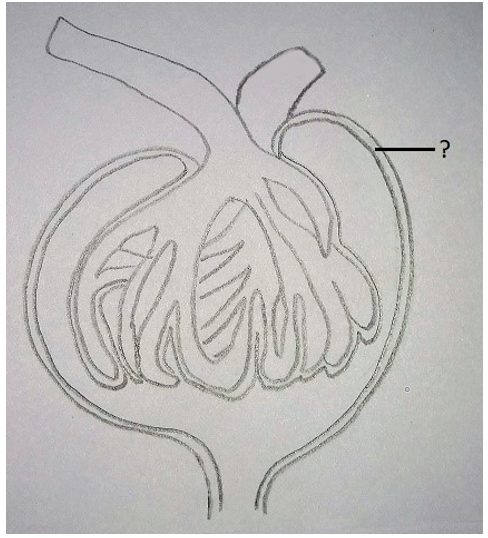 Bowman’s capsule in Malpighian body or a renal corpuscle