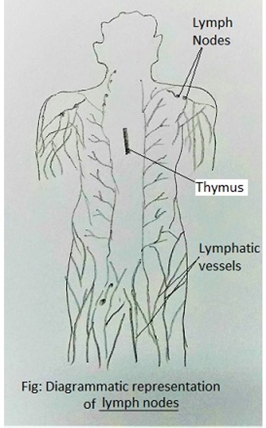 Diagramatic representation of lymph nodes with lympf nodes & spleen