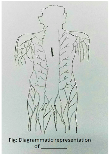 Diagram representation of Lymph nodes located at different points