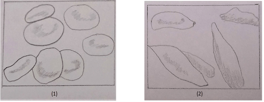 The figure represents micrograph of RBCs from a normal individual