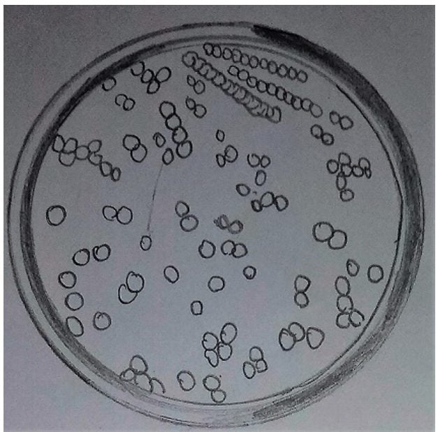 Colonies of bacteria on a petri dish