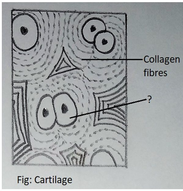 A chondrocyte or a cartilage cell enclosed in small cavities
